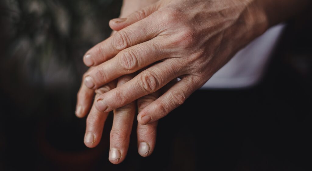 Mani secche e screpolate: come proteggerle dal freddo e dai lavaggi frequenti Mani secche e screpolate: come proteggerle dal freddo e dai lavaggi frequenti